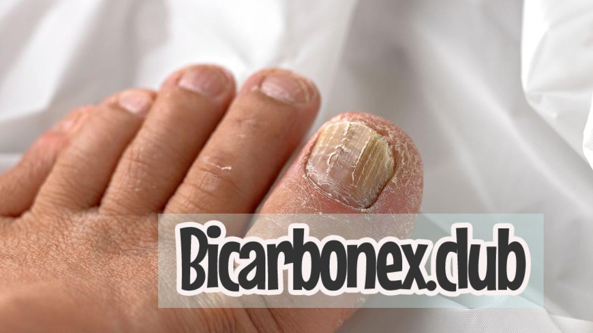Cómo eliminar los hongos de las uñas de los pies con bicarbonato