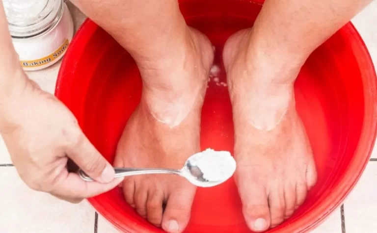 Cómo eliminar los hongos de las uñas de los pies con bicarbonato: trucos efectivos y naturales
