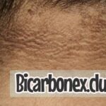 Elimina las manchas oscuras del cuello utilizando bicarbonato de sodio: Guía paso a paso