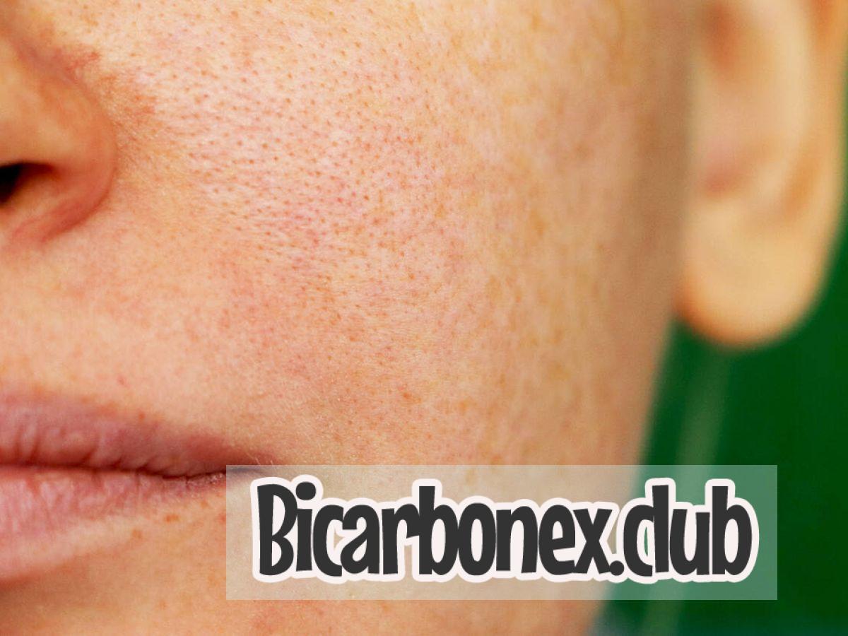 quitar manchas de la cara en una semana con bicarbonato